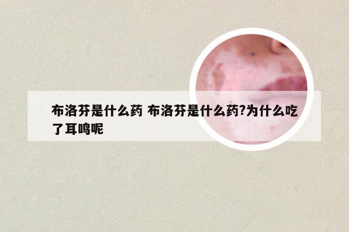 布洛芬是什么药 布洛芬是什么药?为什么吃了耳鸣呢