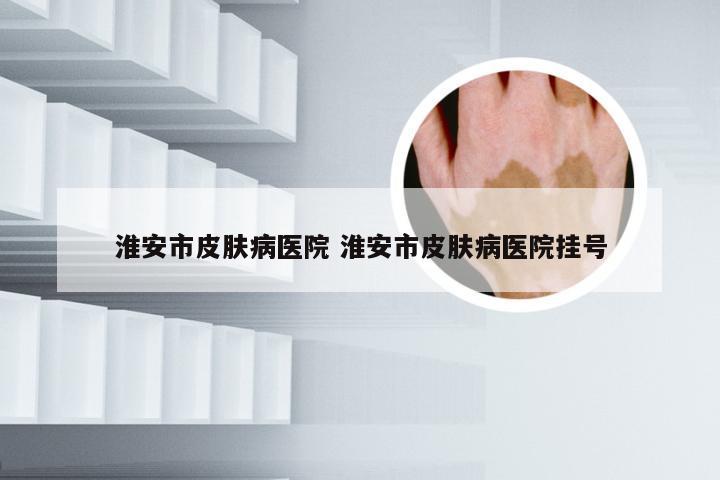 淮安市皮肤病医院 淮安市皮肤病医院挂号