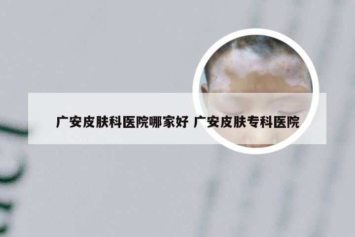 广安皮肤科医院哪家好 广安皮肤专科医院