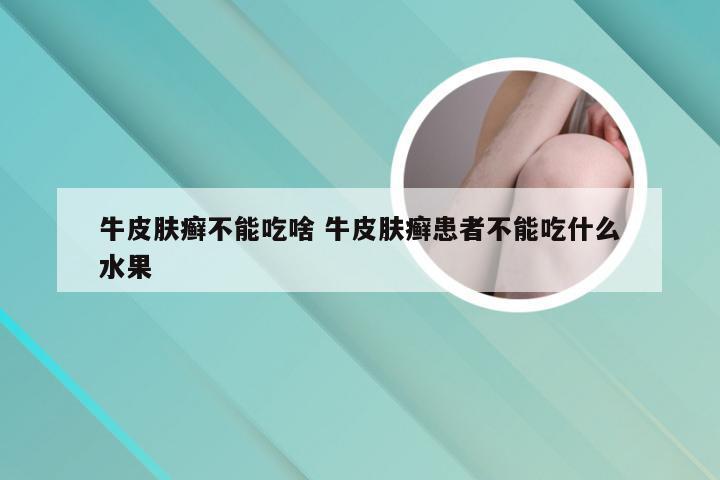 牛皮肤癣不能吃啥 牛皮肤癣患者不能吃什么水果