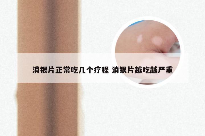 消银片正常吃几个疗程 消银片越吃越严重