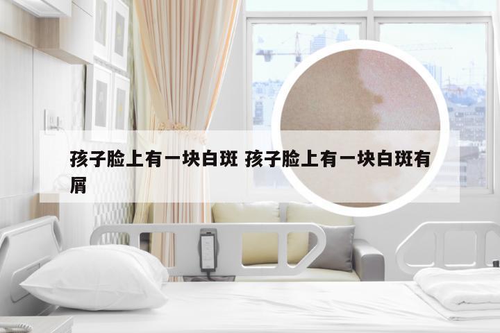孩子脸上有一块白斑 孩子脸上有一块白斑有屑