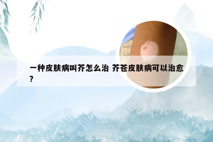 一种皮肤病叫芥怎么治 芥苍皮肤病可以治愈?