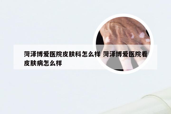 菏泽博爱医院皮肤科怎么样 菏泽博爱医院看皮肤病怎么样