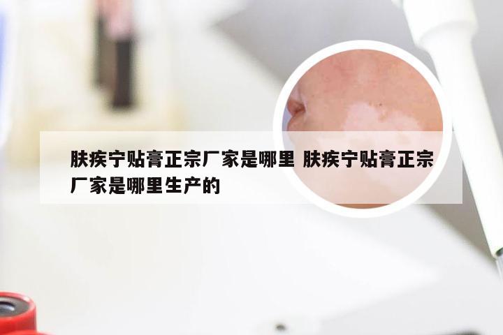 肤疾宁贴膏正宗厂家是哪里 肤疾宁贴膏正宗厂家是哪里生产的