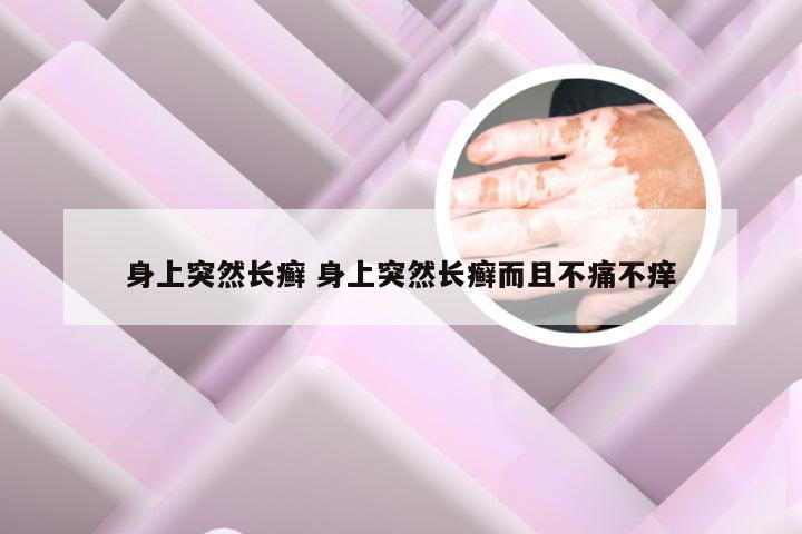 身上突然长癣 身上突然长癣而且不痛不痒