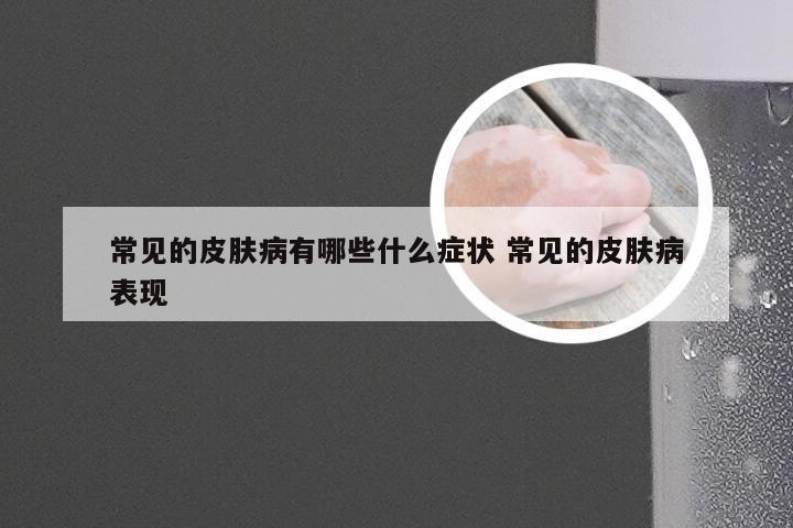 常见的皮肤病有哪些什么症状 常见的皮肤病表现