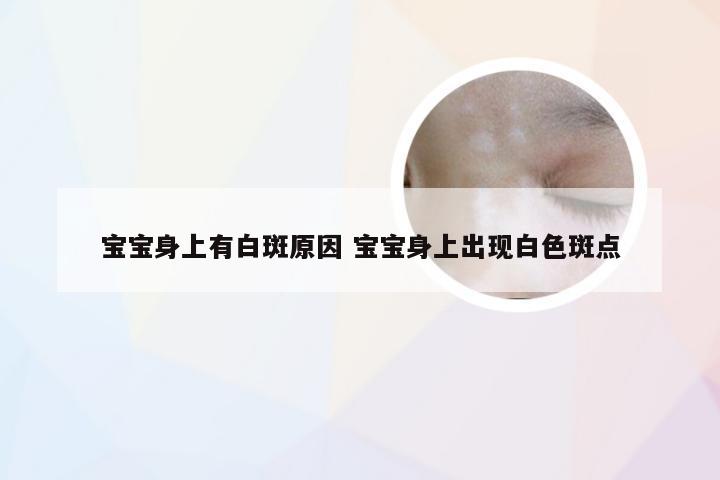 宝宝身上有白斑原因 宝宝身上出现白色斑点