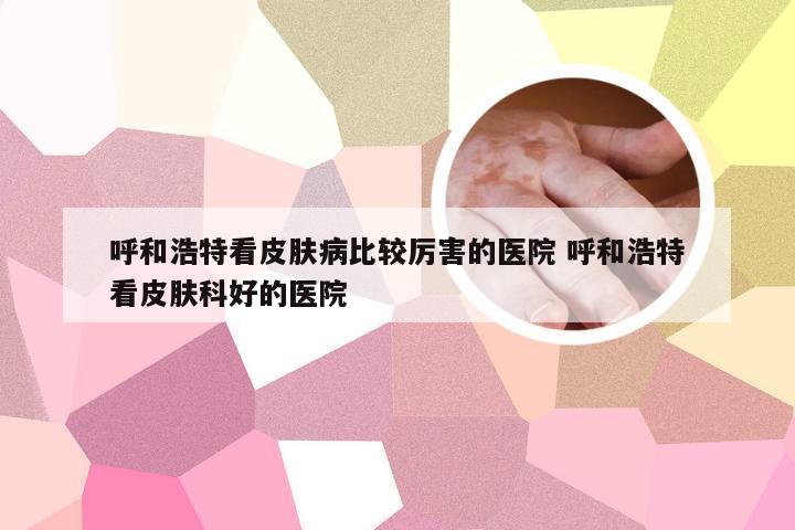 呼和浩特看皮肤病比较厉害的医院 呼和浩特看皮肤科好的医院