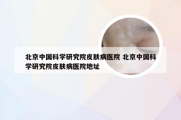 北京中国科学研究院皮肤病医院 北京中国科学研究院皮肤病医院地址