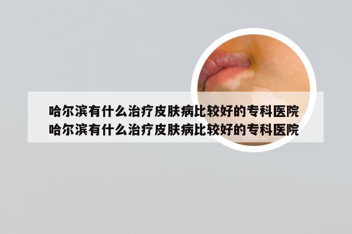 哈尔滨有什么治疗皮肤病比较好的专科医院 哈尔滨有什么治疗皮肤病比较好的专科医院