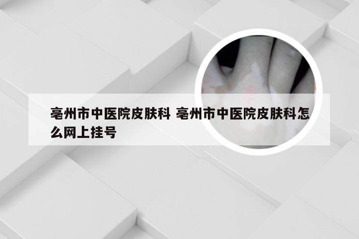 亳州市中医院皮肤科 亳州市中医院皮肤科怎么网上挂号
