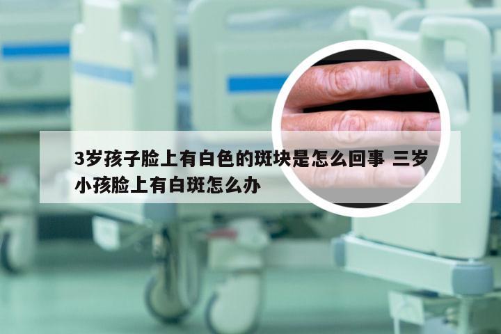 3岁孩子脸上有白色的斑块是怎么回事 三岁小孩脸上有白斑怎么办