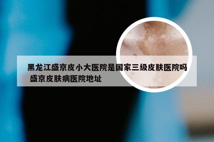 黑龙江盛京皮小大医院是国家三级皮肤医院吗 盛京皮肤病医院地址