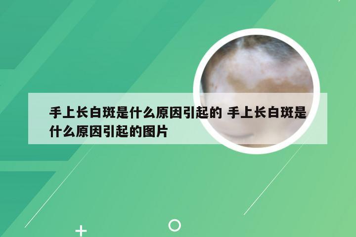 手上长白斑是什么原因引起的 手上长白斑是什么原因引起的图片