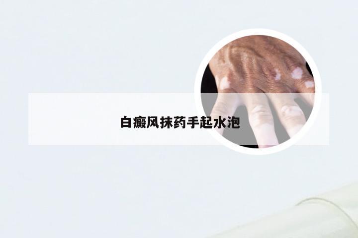 白癜风抹药手起水泡