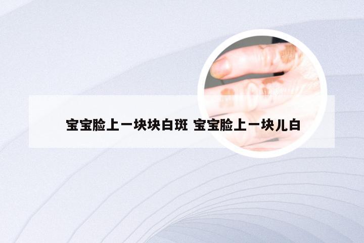 宝宝脸上一块块白斑 宝宝脸上一块儿白