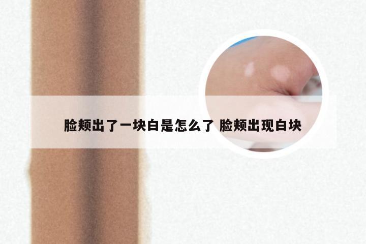 脸颊出了一块白是怎么了 脸颊出现白块
