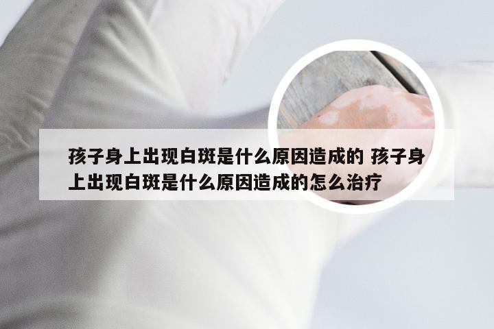 孩子身上出现白斑是什么原因造成的 孩子身上出现白斑是什么原因造成的怎么治疗