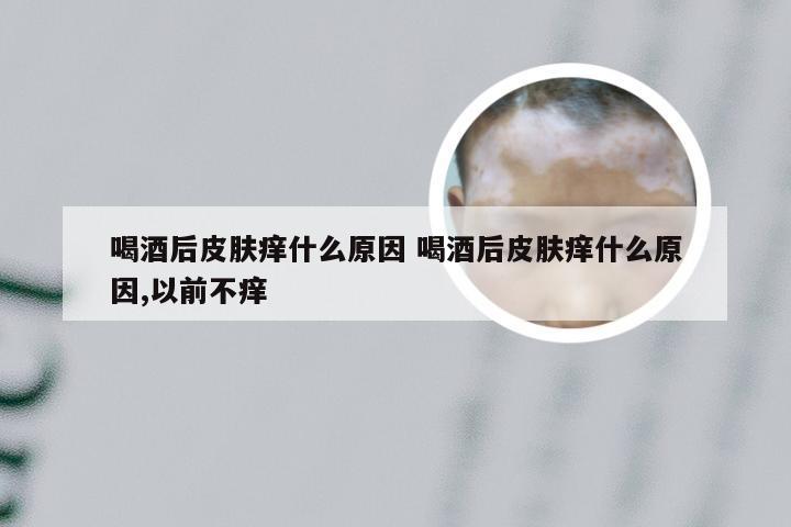 喝酒后皮肤痒什么原因 喝酒后皮肤痒什么原因,以前不痒