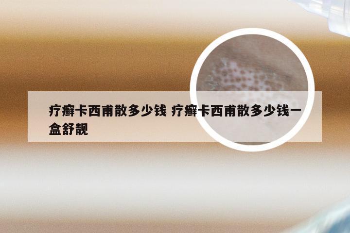 疗癣卡西甫散多少钱 疗癣卡西甫散多少钱一盒舒靓