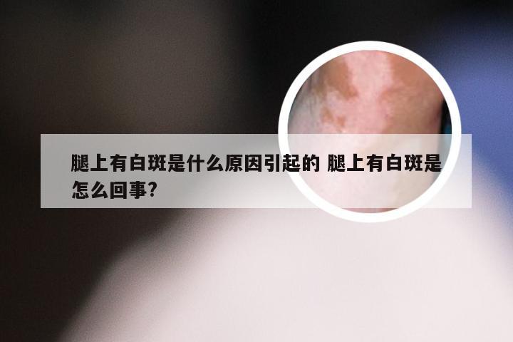 腿上有白斑是什么原因引起的 腿上有白斑是怎么回事?