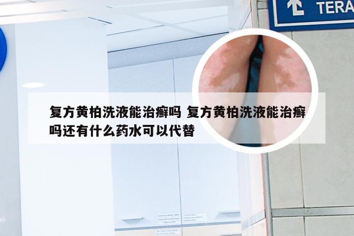 复方黄柏洗液能治癣吗 复方黄柏洗液能治癣吗还有什么药水可以代替