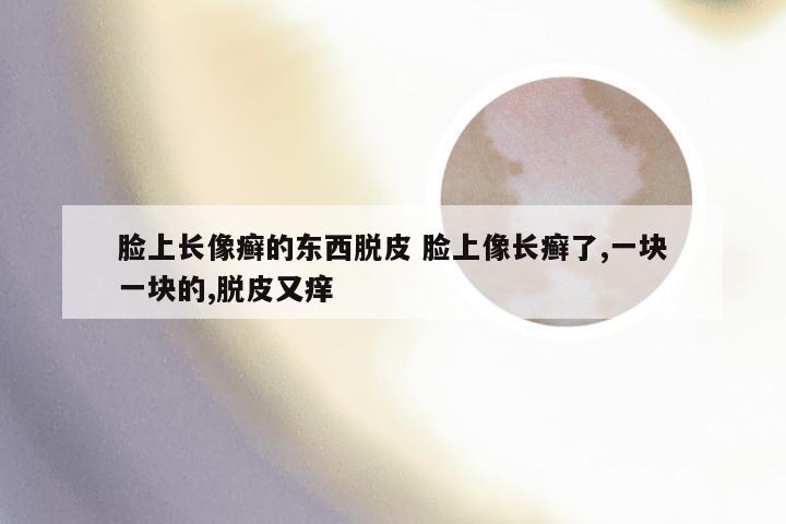 脸上长像癣的东西脱皮 脸上像长癣了,一块一块的,脱皮又痒