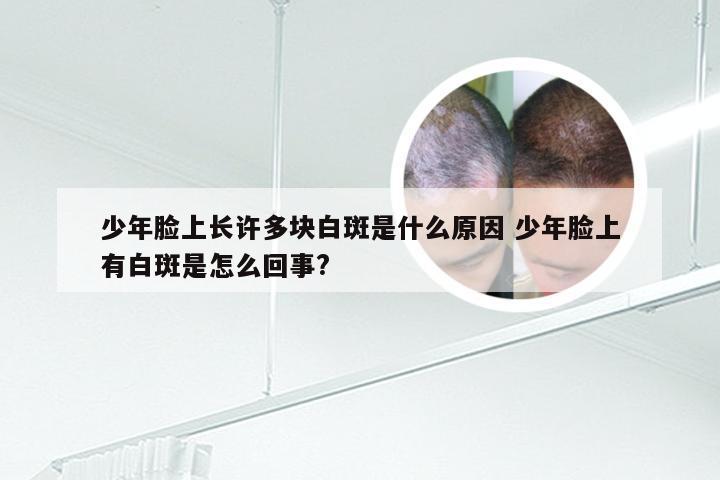 少年脸上长许多块白斑是什么原因 少年脸上有白斑是怎么回事?