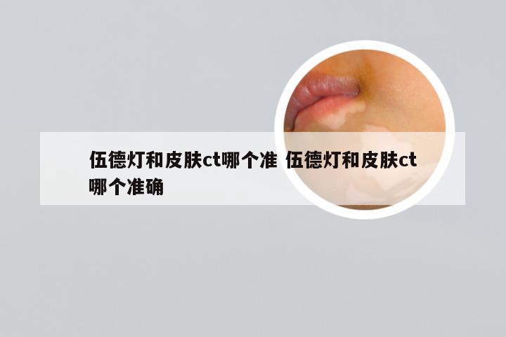 伍德灯和皮肤ct哪个准 伍德灯和皮肤ct哪个准确