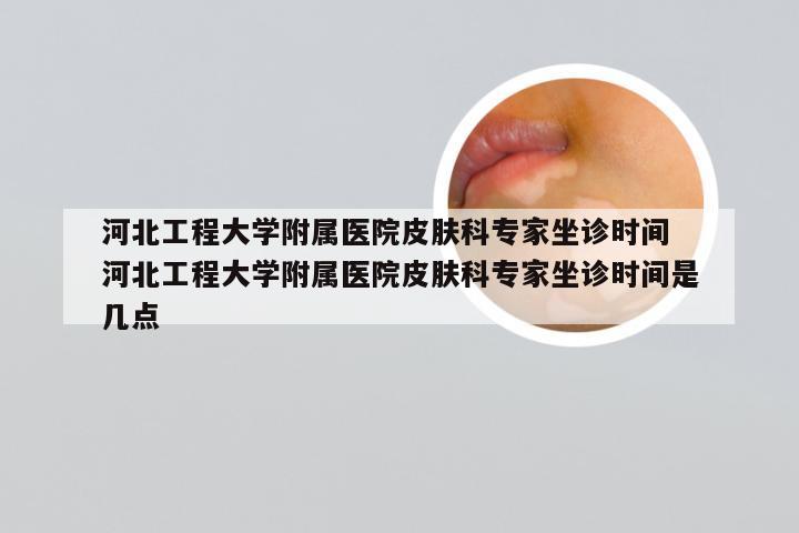 河北工程大学附属医院皮肤科专家坐诊时间 河北工程大学附属医院皮肤科专家坐诊时间是几点