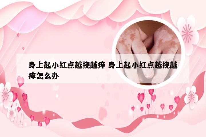 身上起小红点越挠越痒 身上起小红点越挠越痒怎么办