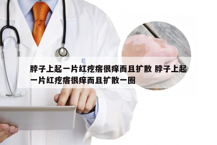 脖子上起一片红疙瘩很痒而且扩散 脖子上起一片红疙瘩很痒而且扩散一圈