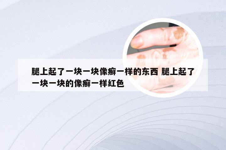 腿上起了一块一块像癣一样的东西 腿上起了一块一块的像癣一样红色