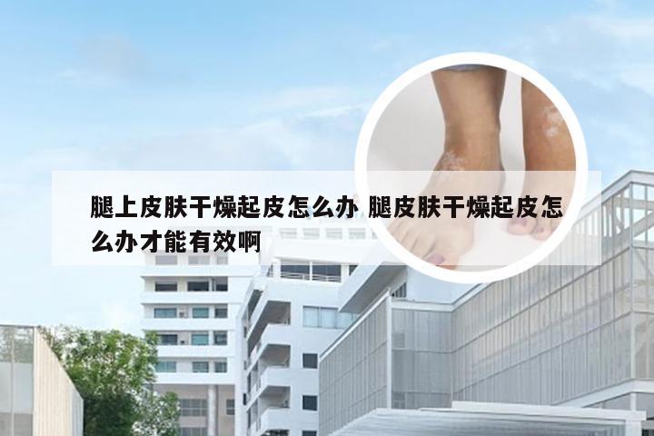 腿上皮肤干燥起皮怎么办 腿皮肤干燥起皮怎么办才能有效啊