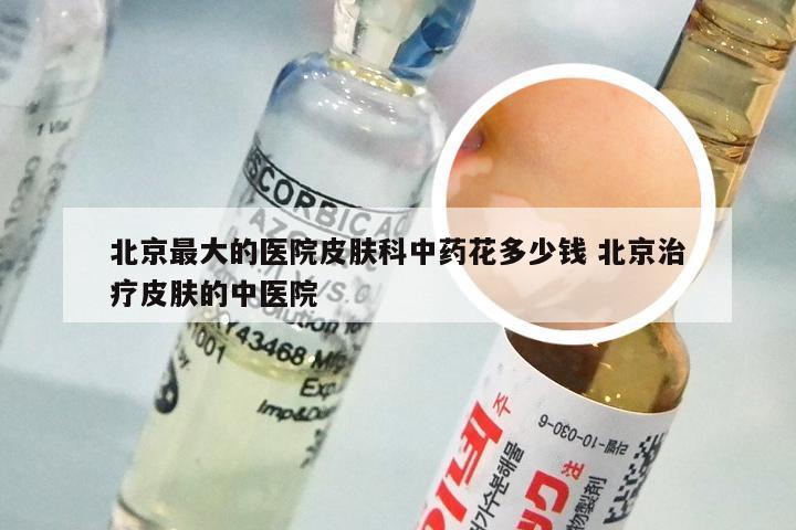 北京最大的医院皮肤科中药花多少钱 北京治疗皮肤的中医院