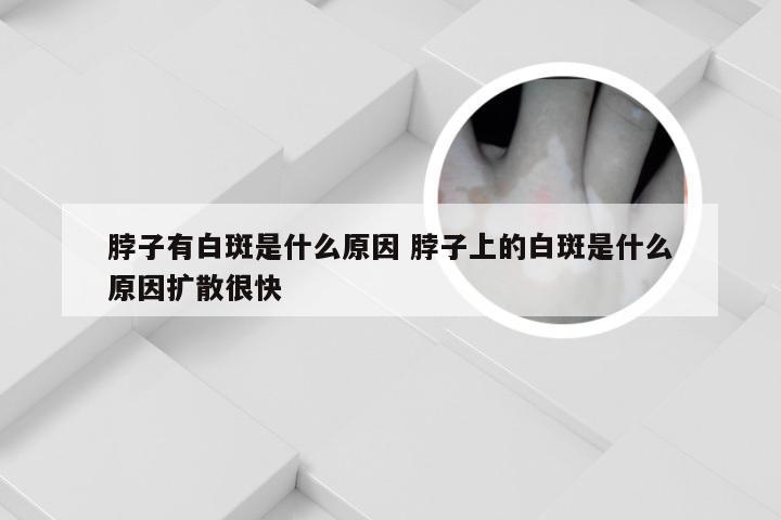 脖子有白斑是什么原因 脖子上的白斑是什么原因扩散很快