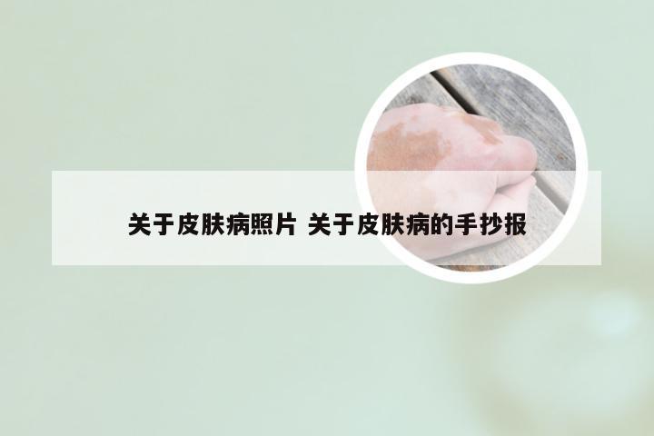 关于皮肤病照片 关于皮肤病的手抄报