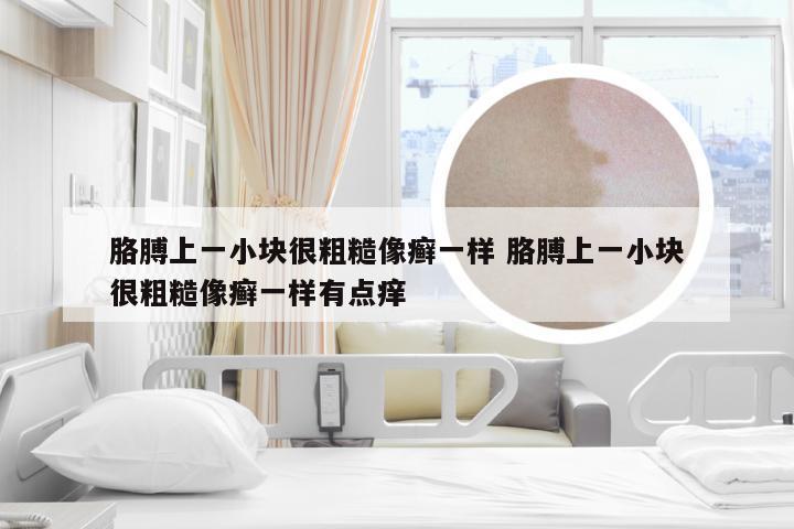 胳膊上一小块很粗糙像癣一样 胳膊上一小块很粗糙像癣一样有点痒