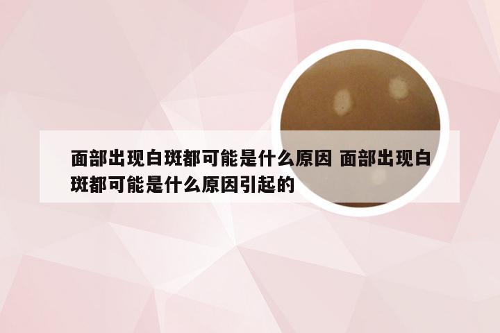 面部出现白斑都可能是什么原因 面部出现白斑都可能是什么原因引起的