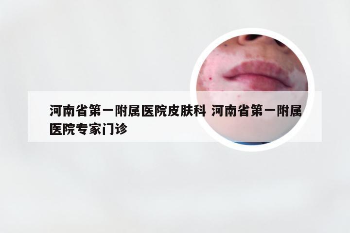 河南省第一附属医院皮肤科 河南省第一附属医院专家门诊
