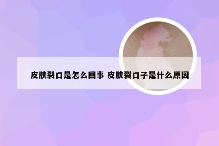 皮肤裂口是怎么回事 皮肤裂口子是什么原因