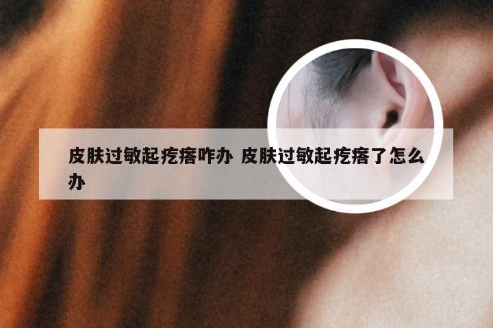 皮肤过敏起疙瘩咋办 皮肤过敏起疙瘩了怎么办