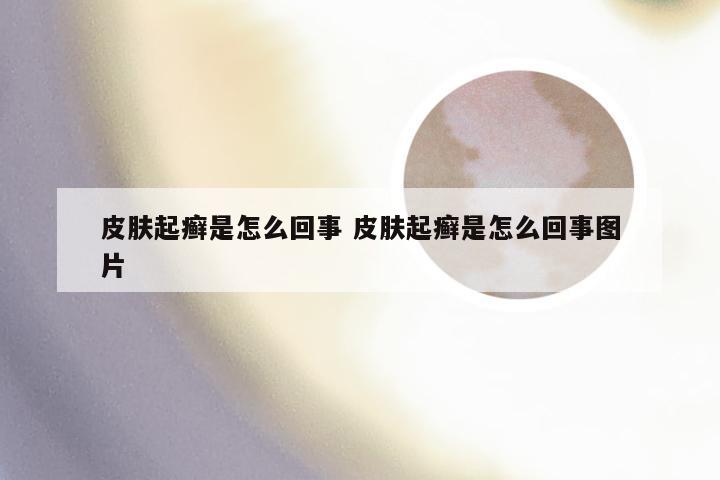皮肤起癣是怎么回事 皮肤起癣是怎么回事图片