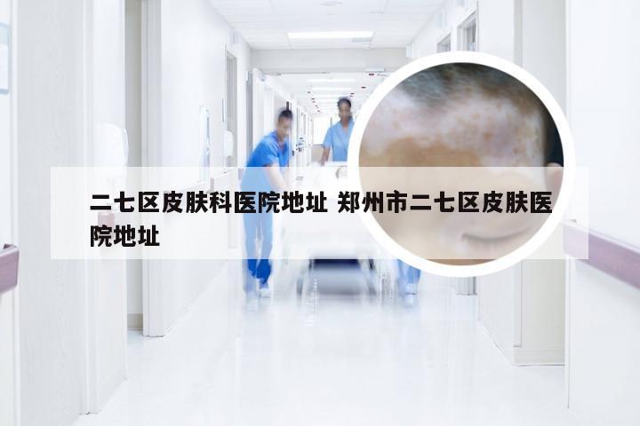 二七区皮肤科医院地址 郑州市二七区皮肤医院地址