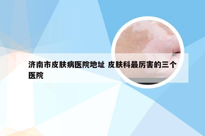 济南市皮肤病医院地址 皮肤科最厉害的三个医院