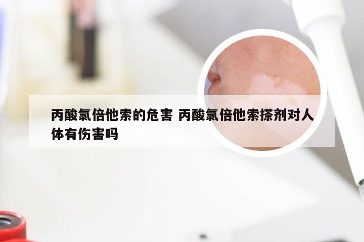 丙酸氯倍他索的危害 丙酸氯倍他索搽剂对人体有伤害吗