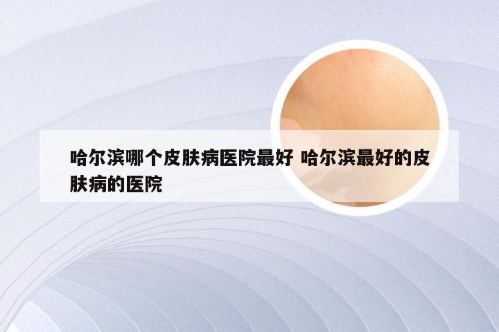 哈尔滨哪个皮肤病医院最好 哈尔滨最好的皮肤病的医院