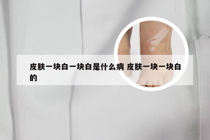 皮肤一块白一块白是什么病 皮肤一块一块白的