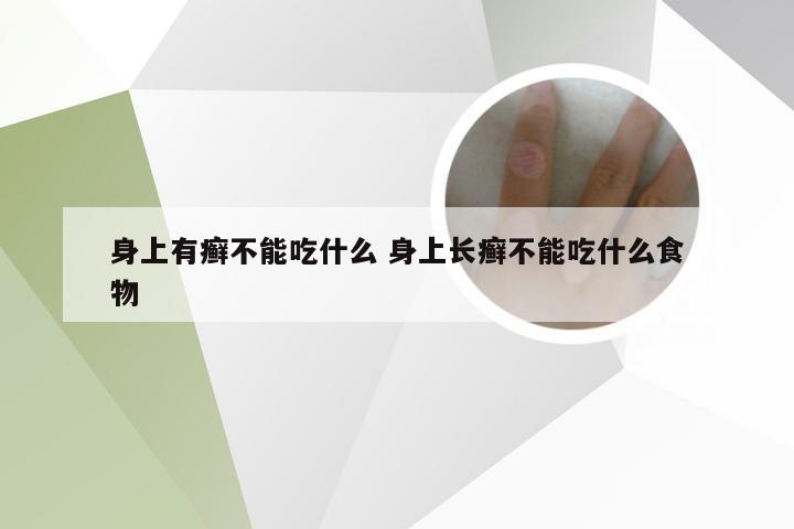 身上有癣不能吃什么 身上长癣不能吃什么食物